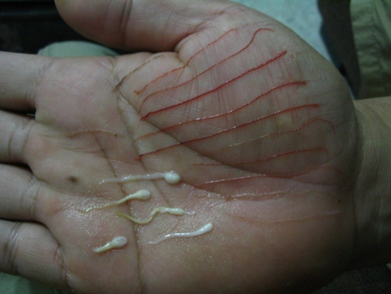 Parasitic worms in fish Page 2 FishingKaki com