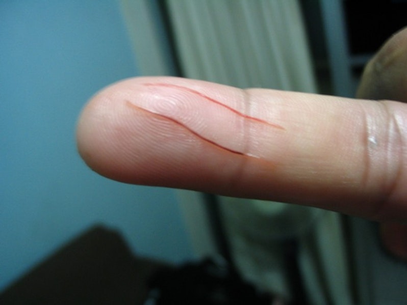 Parasitic worms in fish.